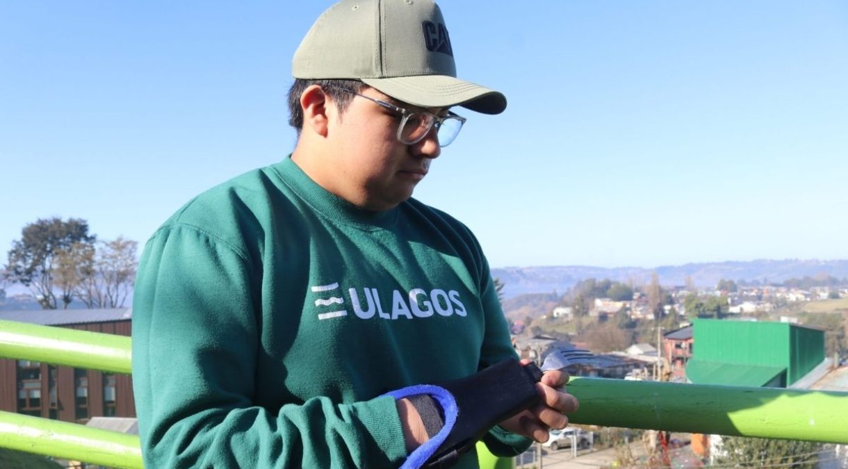 primera protesis ulagos